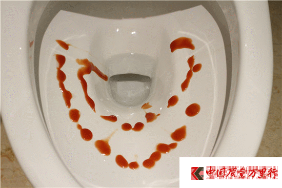 智能馬桶深度體驗記:TOTO座便器居然有這么多槽點!