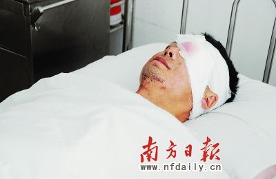 手機(jī)電池床頭充電炸傷男子左眼