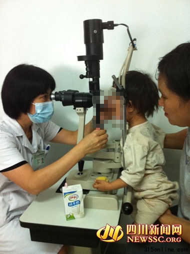 兩歲女童眼內長出拳頭大腫瘤或為惡性手術堪憂