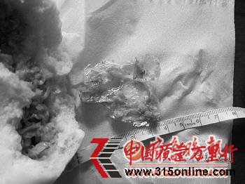 ▲圖為包子中吃出的塑料袋(陳女士提供)。 ▲圖為包子中吃出的塑料袋(陳女士提供)。