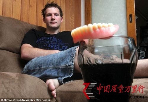 現在,年僅25歲的肯維爾已經戴上了假牙。(資料圖片)