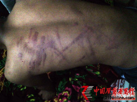 網曝云南省富源縣一名老師持續4小時體罰學生，期間打斷5根電線。（圖為被體罰學生）網絡截圖